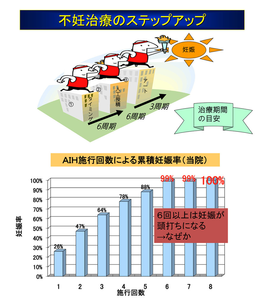 不妊治療ステップアップ